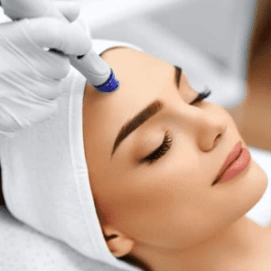 Microneedling beauty by layla